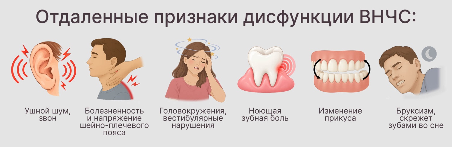 Местные признаки дисфункции ВНЧС